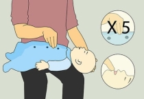 Từ vụ bé trai hóc nhãn phải sống thực vật: Bác sĩ chỉ cách sơ cứu cha mẹ nào cũng cần biết Từ vụ bé trai hóc nhãn phải sống thực vật: Bác sĩ chỉ cách sơ cứu cha mẹ nào cũng cần biết