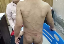 Đã có kết luận thương tích bé trai bị cha dượng đánh dã man ở Phú Quốc Đã có kết luận thương tích bé trai bị cha dượng đánh dã man ở Phú Quốc